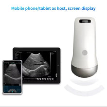 Wireless ultrasound