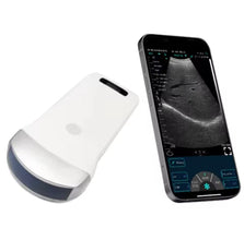 Wireless ultrasound